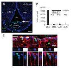 Increased production of neurons in hypothalamus found in mice fed high fat diets