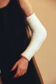 Long arm cast best for immobilizing forearm