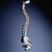 Lowest fused vertebral level linked to motion in scoliosis