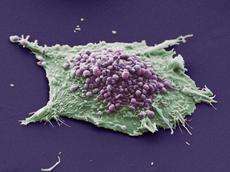 Detecting tumour cells individually