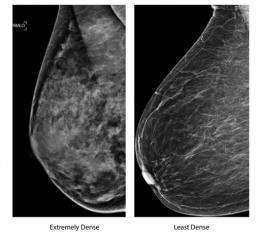 乳房X线照片和密集的乳房_问题比比皆是