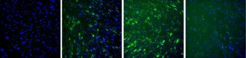 Molecular beacons light up stem cell transformation