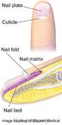New peri-Op approach accurately IDs melanoma in nail matrix