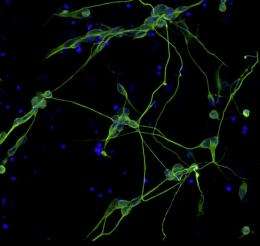 Researchers convert skin and umbilical cord cells directly into nerve cell
