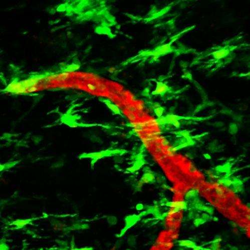 NIH-funded researchers show possible trigger for MS nerve damage