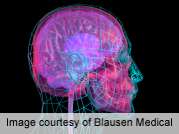 Nonsurgical method to measure brain pressure shows promise