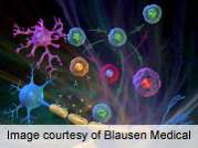 Novel immune target identified in multiple sclerosis