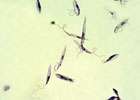 Old drug shows new promise to treat leishmaniasis