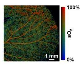 Photoacoustic tomography can 'see' in color and detail several inches beneath the skin