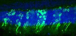 Photoreceptor transplant restores vision in mice