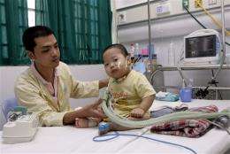 Potent form of common child illness deadly in Asia