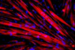 Successful transplant of patient-derived stem cells into mice with muscular dystrophy