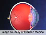 Retinal hemorrhage pattern can predict inflicted brain injury