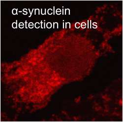 Rice opens new window on Parkinson’s disease