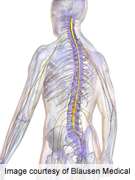 Risk factors for tracheostomy in spinal cord injury identified