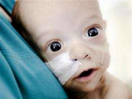 Romanian baby born with stunted intestines dies (AP)