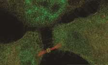 Gene gives cells a 'safety belt' against genetic damage