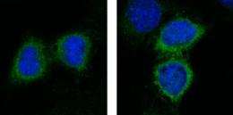 Scientists aim to kill lung tumors