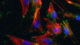 Smooth muscle cells created from patients' skin cells