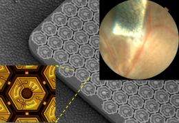 Solar-panel-like retinal prosthesis could better restore sight to blind