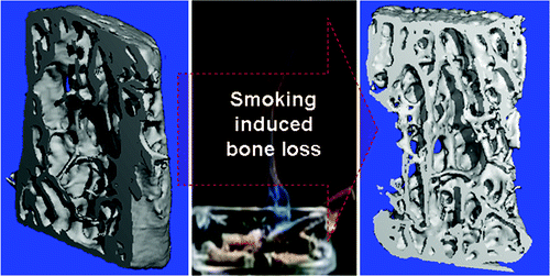 Solving the mystery of how cigarette smoking weakens bones