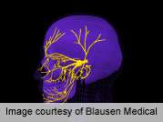 Some face transplant patients may regain sensory, motor function