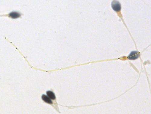 Sperm length variation is not a good sign for fertility