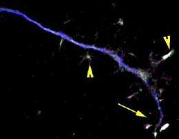 Stay-at-home transcription factor prevents neurodegeneration