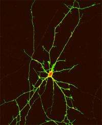 Stem cells hint at potential treatment for Huntington's Disease