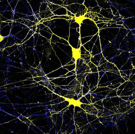 'Stoned' gene key to maintaining normal brain function