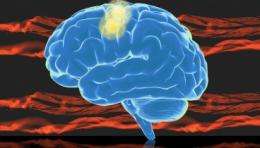 Stroke disrupts how brain controls muscle synergies