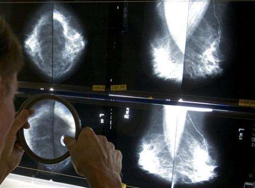 Study finds mammograms lead to unneeded treatment