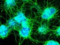 Study gives clues to causes of Motor Neurone Disease