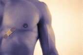 Study links another gene variant to male breast cancer