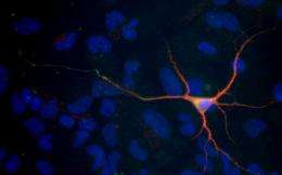 Taking the fate of stem cells in hand: Researchers generate immature nerve cells