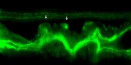 Tension on gut muscles induces cell invasion in zebrafish intestine, mimicking cancer metastasis