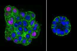 To revert breast cancer cells, give them the squeeze