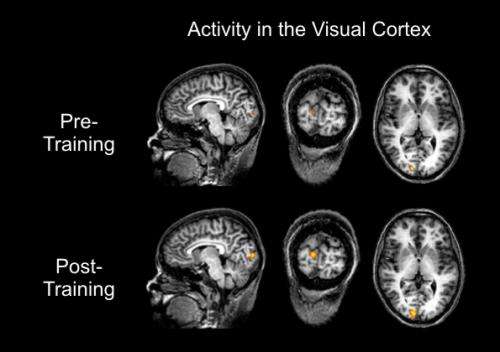 Learning to control brain activity improves visual sensitivity