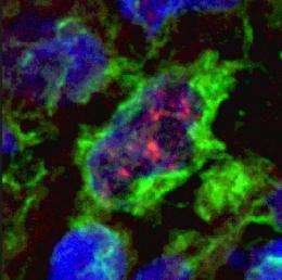 UCLA scientists identify novel pathway for T-cell activation in leprosy