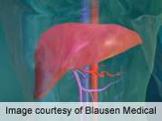U.S. liver transplants declining