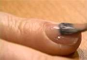 UV nail lamps do not significantly up skin cancer risk