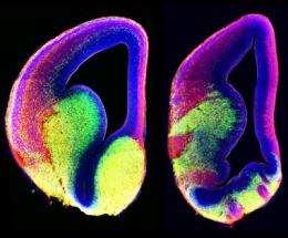 通过观察大脑的发育，科学家们收集了神经系统紊乱的线索
