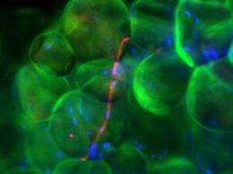 Why do fat cells get fat? New suspect ID'd