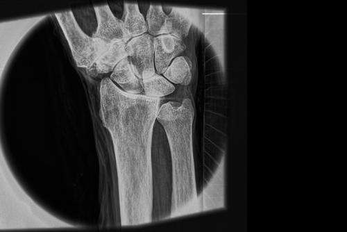 A leap forward in X-ray technology