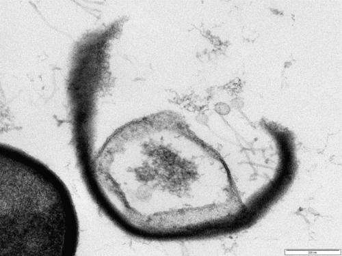 Bacteria-eating viruses 'magic bullets in the war on superbugs'