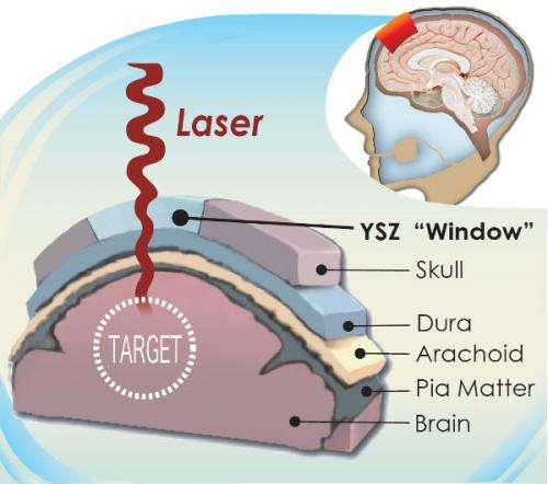 Creating a 'window' to the brain