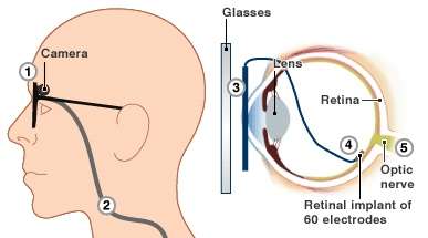 Engineer invents bionic eye to help the blind