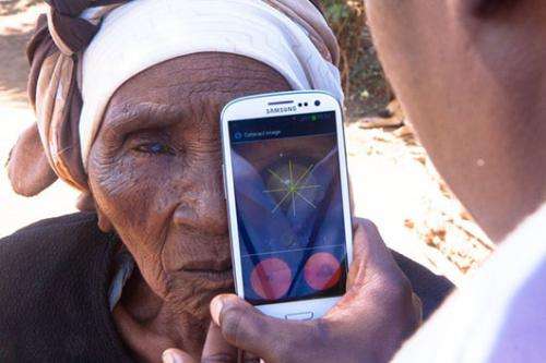 'Eye-phone' that could help prevent blindness