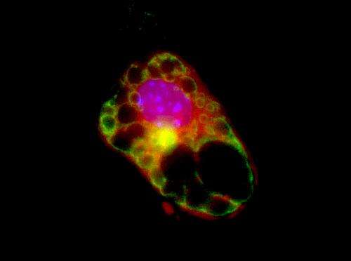 Fighting fat with fat: Stem cell discovery identifies potential obesity treatment