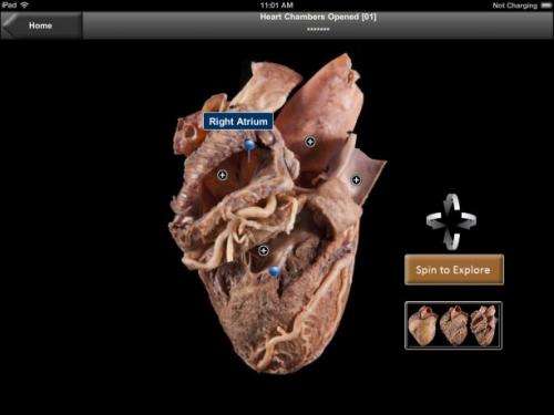 New app lets med students study real human heart on iPad